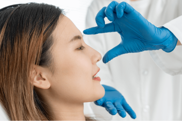 Rinoplastia