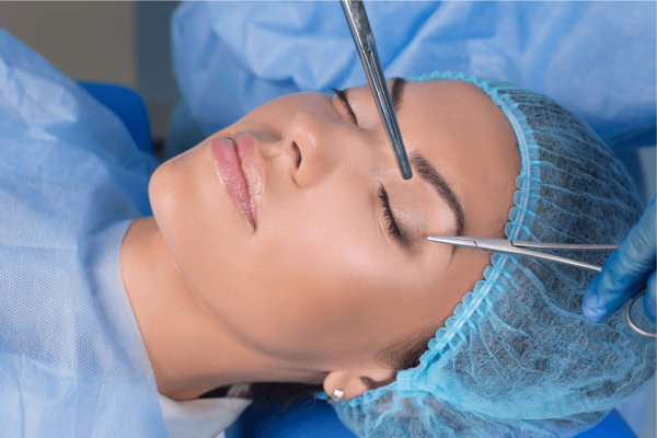 blefaroplastia