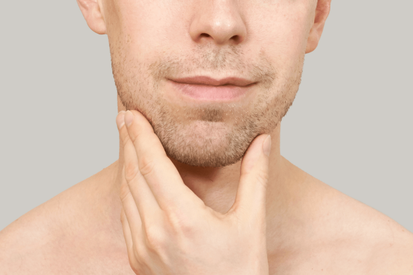 Implantes faciales